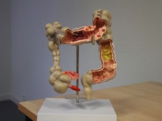 anatomisch model dikkedarm